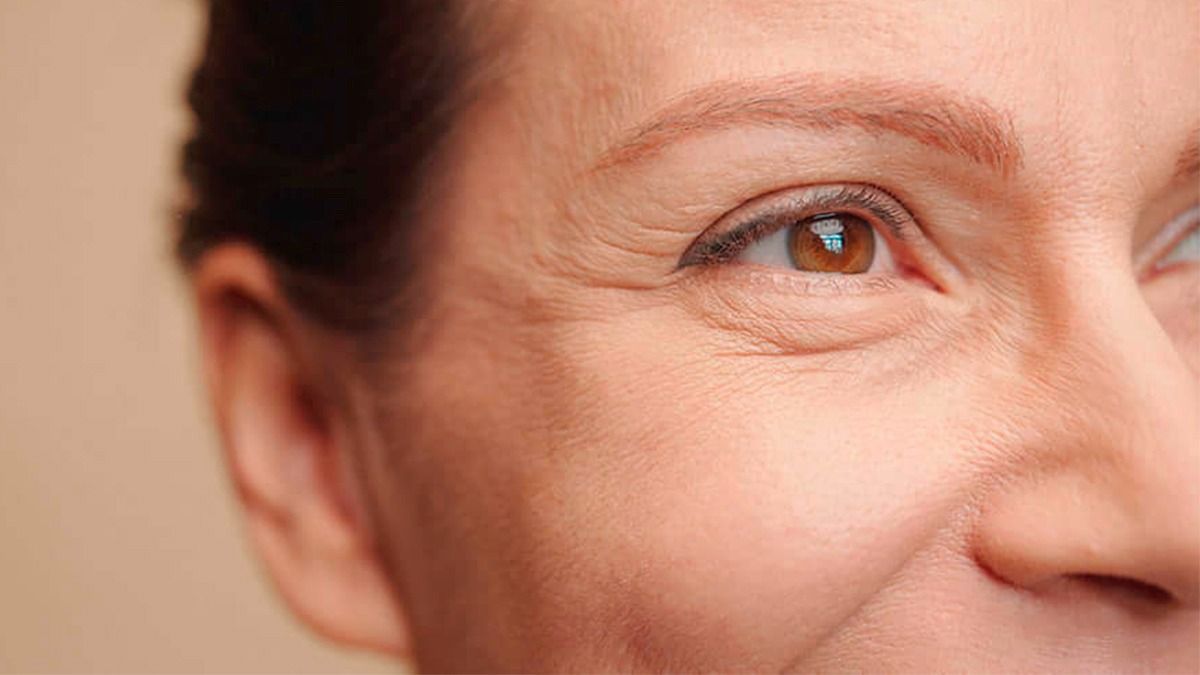 „Bügeleisen” für Falten. Reiben Sie täglich einige Tropfen in die Gesichtshaut ein.